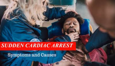 Sudden Cardiac Arrest: Signs, Risk Factors, Causes And Treatment- Steps To Perform CPR