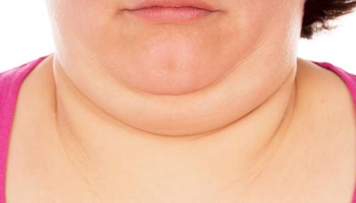 Want To Get Rid Of That Stubborn Double Chin? Try These Facial Yoga Exercises