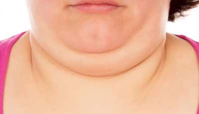 Want To Get Rid Of That Stubborn Double Chin? Try These Facial Yoga Exercises