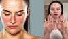 Selena Gomez Calls Lupus A Daily Struggle: From Joint Pain To Skin Rashes- Early Symptoms, Causes And Treatment