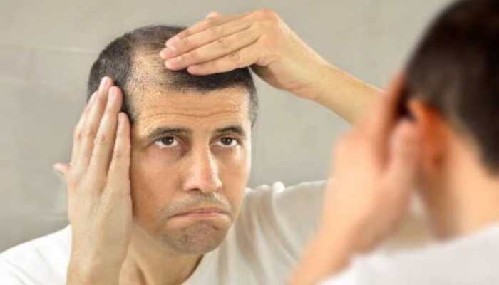18 Causes of Hair Loss and How to Treat It
