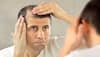 Thinning Hair Troubles? Expert Explains Do’s And Don'ts To Follow For Hair Growth 