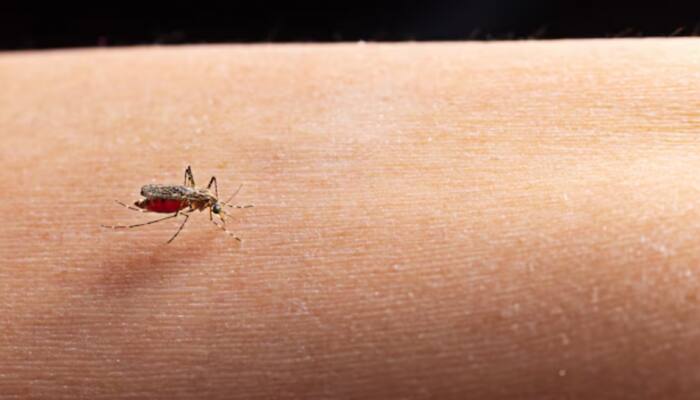 Monsoon Health Tips: Dengue, Flu And Water-Borne Diseases On The Rise, Check Expert's Advice