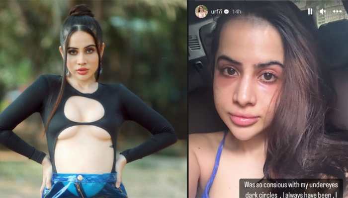 My Face Looks F**ked Up: Urfi Javed Regrets Getting Eye-Fillers After Being Trolled