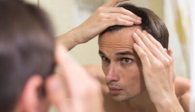 EXCLUSIVE: Common Doubts And Misconceptions About Hair Transplants, Expert Spells Out