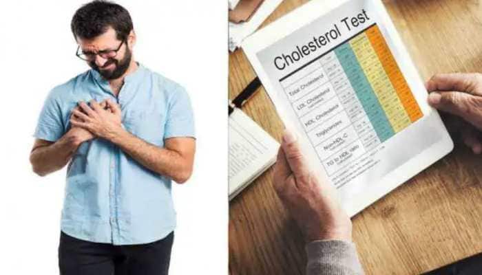 8 Effective Lifestyle Changes To Control Cholesterol Levels