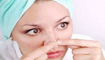 Beauty Tips: 7 Effective Home Remedies To Remove Blackheads