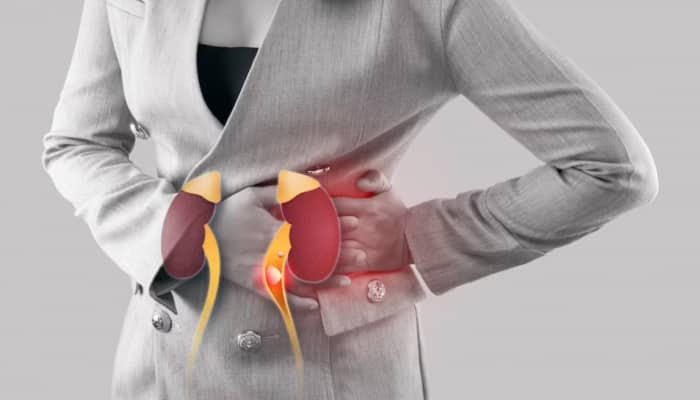 From Adequate Sleep To Regular Exercise: 7 Ways Your Lifestyle Affects Your Kidneys- Experts Weigh In