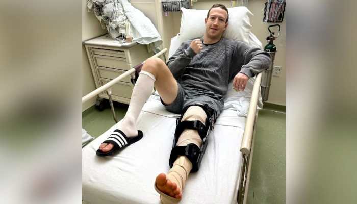 Mark Zuckerberg Undergoes Knee Surgery; Shares Pics On Instagram