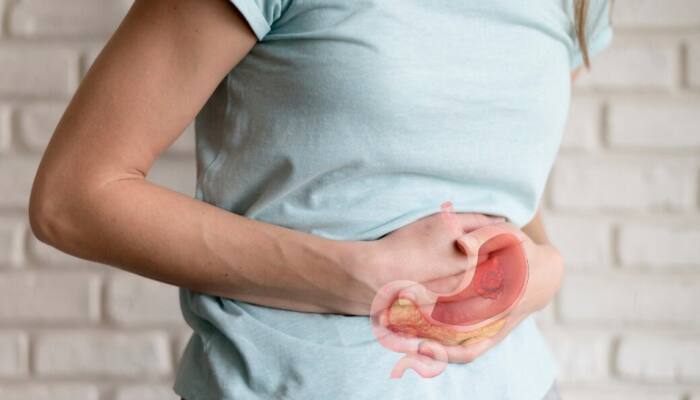 Is Loss Of Appetite Sign Of Stomach Cancer? Check Symptoms And Early Diagnosis, Expert Shares