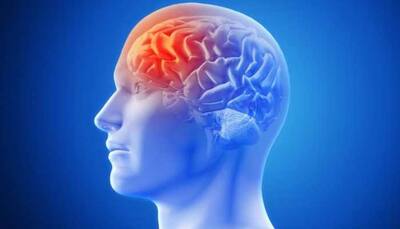 Brain Stroke: Symptoms, Prevention And Why You Should Rush To Hospital Immediately 