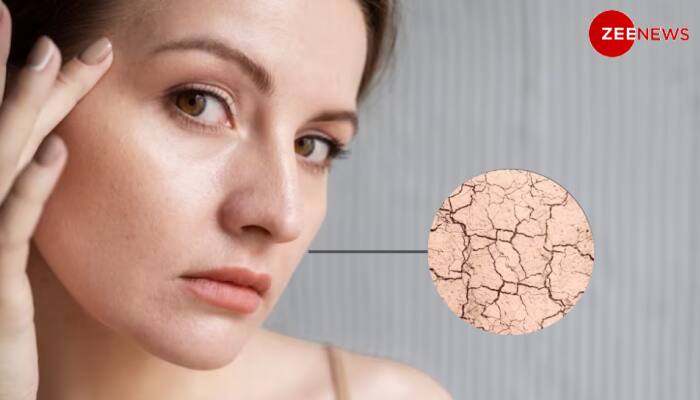Is Your Skin Dehydrated Or Is It Dry? Know The Difference