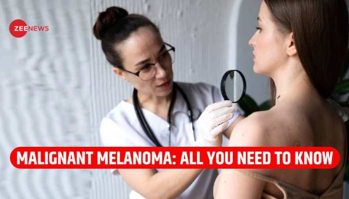 Malignant Melanoma: Know All About Deadly Form Of Skin Cancer That Duchess Of York Was Diagnosed With