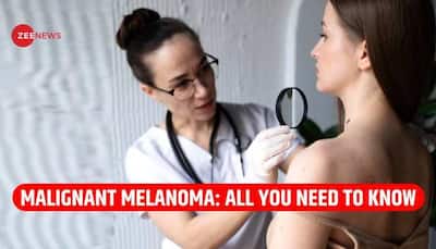 Malignant Melanoma: Know All About Deadly Form Of Skin Cancer That Duchess Of York Was Diagnosed With