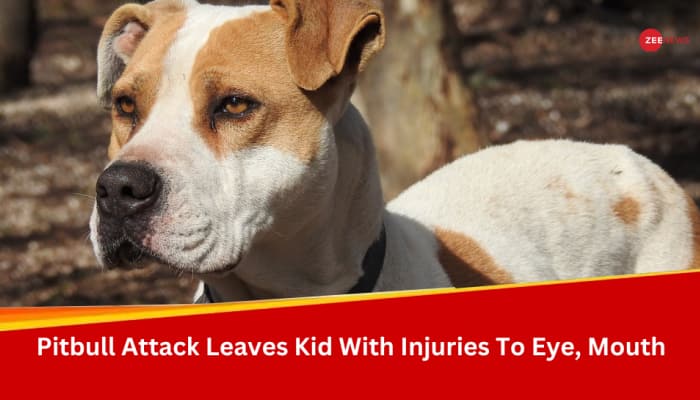 Ghaziabad: Another Horrific Pitbull Attack, 10 Yr Old Girl Critically Injured