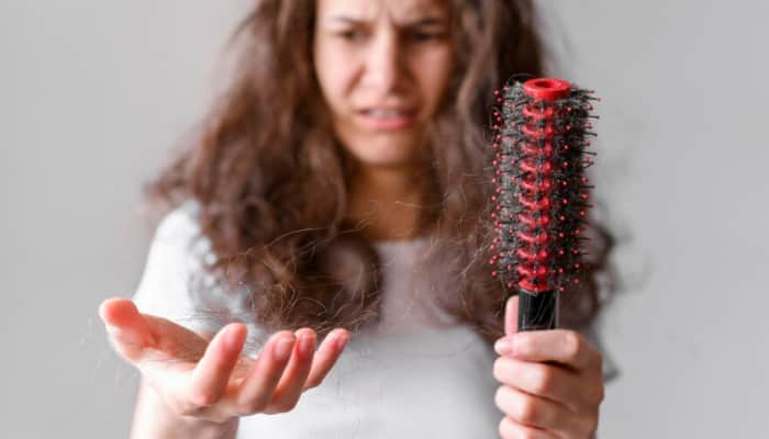 Experiencing Too Much Hair Fall? 5 Ways To Cope With Stress-induced Hair Loss, Expert Shares