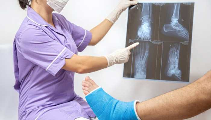 Men Have A Greater Risk Of Fractures From Falls Than Women: Study