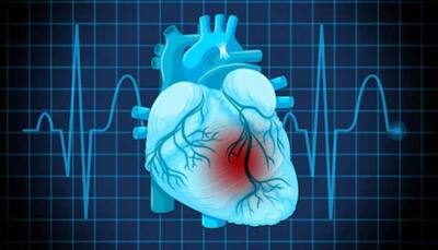 Outlook On Emerging Therapies In Interventional Cardiology