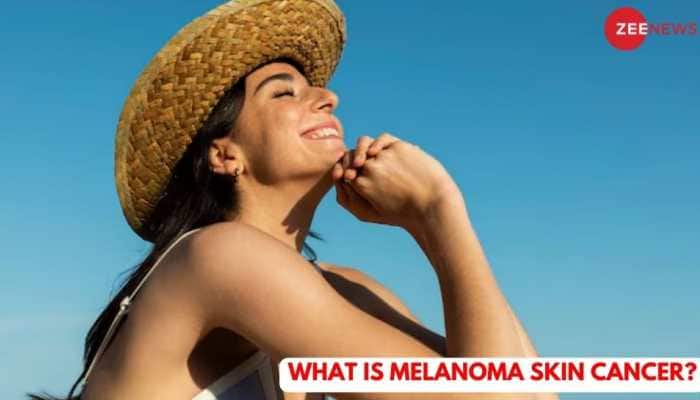 What Is Melanoma Skin Cancer? Symptoms And Safety Tips To Keep In Mind 