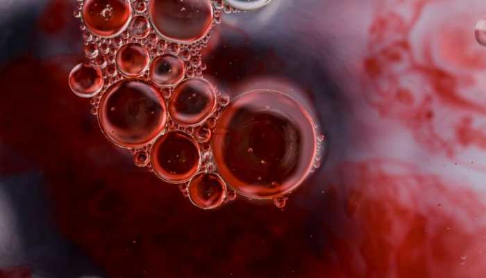 World Blood Cancer Day: Different Types Of Blood Cancers, Symptoms And More - A Layman&#039;s Guide