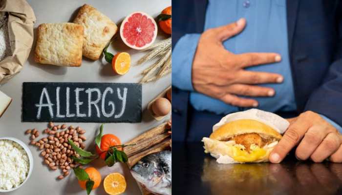 Food Allergy Vs Food Intolerance: What's The Difference?