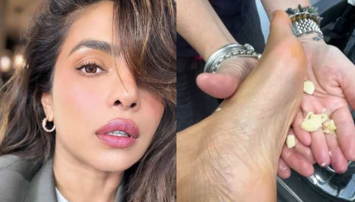 Priyanka Chopra’s Surprising Foot Care Hack: Garlic For Relief?