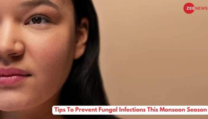 Stay Dry and Healthy: Essential Tips To Prevent Fungal Infections This Monsoon Season
