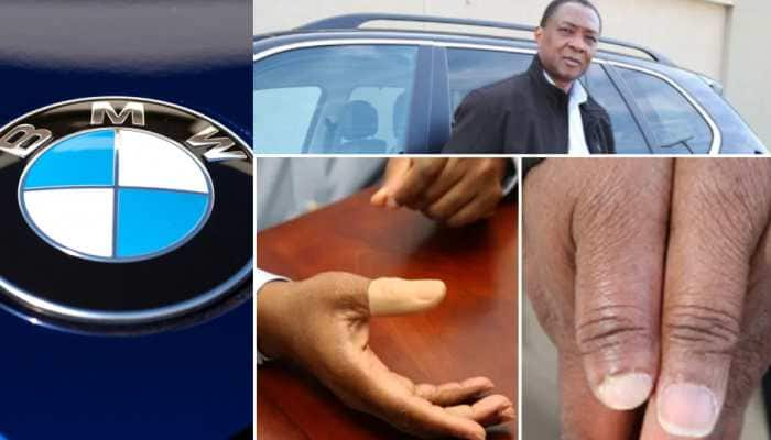 BMW Door Feature Causes Man Lose His Thumb, Slapped &#039;Rs 16 Crore&#039; In Damages