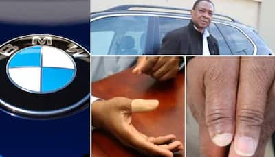 BMW Door Feature Causes Man Lose His Thumb, Slapped 'Rs 16 Crore' In Damages