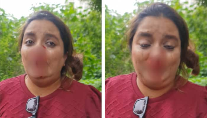 Pune Road Rage: Content Creator Brutally Assaulted By Motorist While On Bike With 2 Children