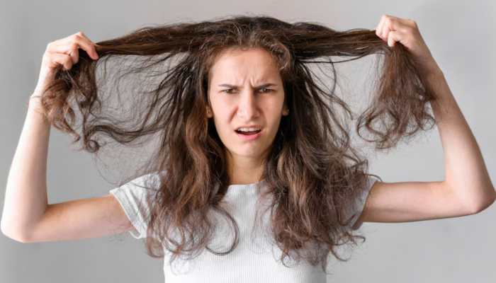 7 Tips For Managing A Greasy Scalp In The Monsoon 