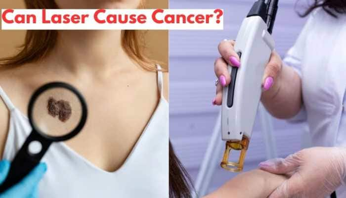 Can Laser Cause Cancer? Check Expert&#039;s Say On This