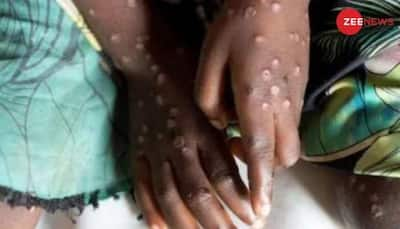 WHO Declares Mpox Outbreak Global Concern