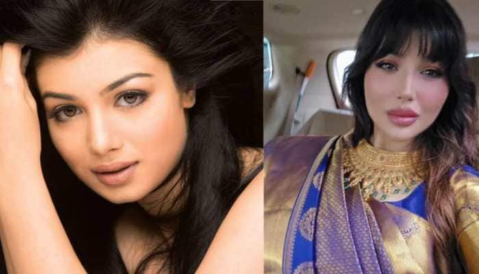 Ayesha Takia Looks Unrecognizable In Latest Pics, &#039;SHOCKED&#039; Netizens Ask &#039;Why You Destroyed Your Face?&#039;