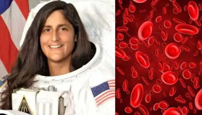 Space Anemia: A Serious Health Risk For NASA Astronaut Sunita Williams