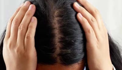 Painful Pimples on Your Scalp? Here’s Why And How To Stop Them