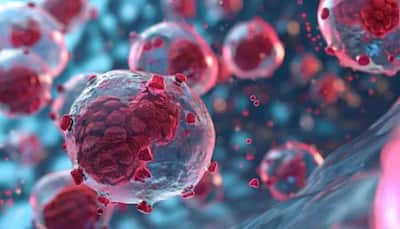 CAR-T Cell Therapy And Bone Marrow Transplant Improving Lymphoma Outcomes: Experts