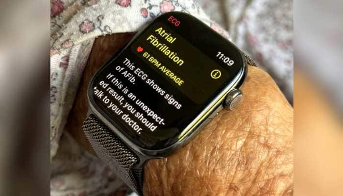 Apple Watch Series 10 Saves Elderly Woman By Detecting Irregular Heartbeat: Netizens React To Life-Saving Feature 