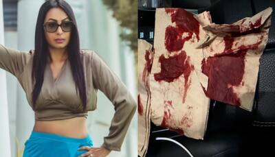 Actress Kashmera Shah Meets With Accident; Says 'Thank u god...'