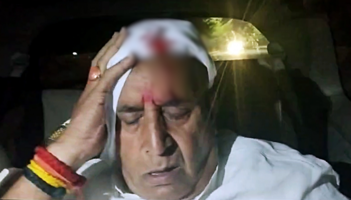 NCP’s Anil Deshmukh Injured In Stone Attack On Campaign Trail In Maharashtra’s Katol NCP’s Anil Deshmukh Injured In Stone Attack On Campaign Trail In Maharashtra’s Katol