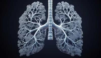 Common Fungal Infection Found To Be Fatal For Lung Disease Patients: AIIMS Study Reveals