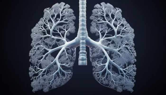 Common Fungal Infection Found To Be Fatal For Lung Disease Patients: AIIMS Study Reveals