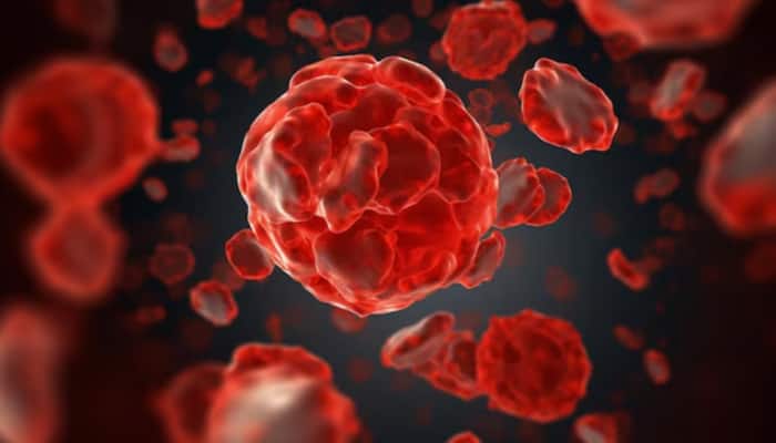 What Is Bleeding Eye Disease: Check Symptoms, Treatment, Prevention, And All You Need To Know