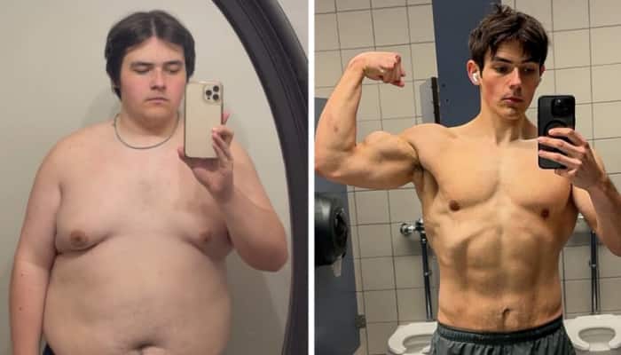 Man Who Shed 60 Kg Reveals The 'Biggest' Mistake People Make When Trying To Lose Weight