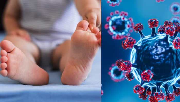 HMPV Virus Now In India! 10 Cases In Total- Follow Dos And Don`ts Guidelines HMPV Virus Now In India! 10 Cases In Total- Follow Dos And Don`ts Guidelines