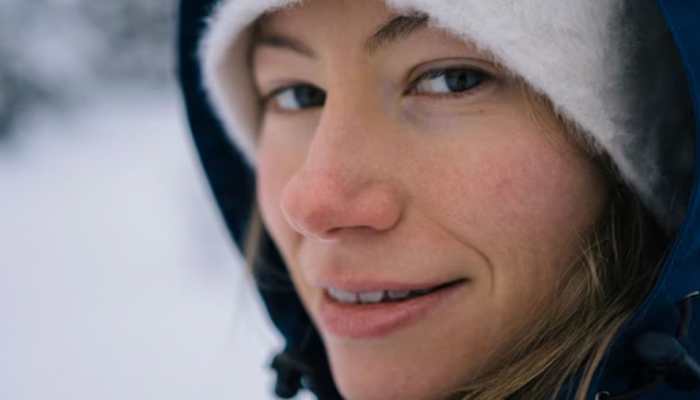 10 Essential Tips To Soothe Your Winter Skin Dryness