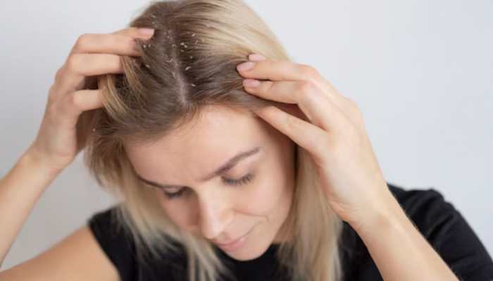 Tips To Nourish The Scalp And Fight Dryness And Flakes; Check Expert Opinion 