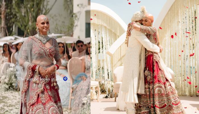 Indian Bride With Alopecia Ditches Wig, Breaks Beauty Norms; Embraces Bald Look In Heartfelt Wedding Video, Watch