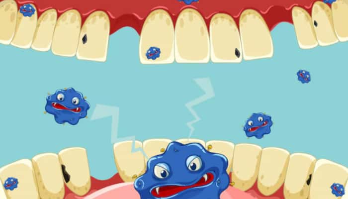 Oral Bacteria And Alzheimer’s: New Study Links Gum Health To Brain Function