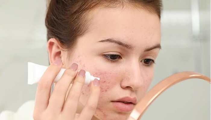 Shop the Best Spot Correctors at Amazing Discounts During Myntra Fashion Carnival (6th - 12th February Shop the Best Spot Correctors at Amazing Discounts During Myntra Fashion Carnival (6th - 12th February